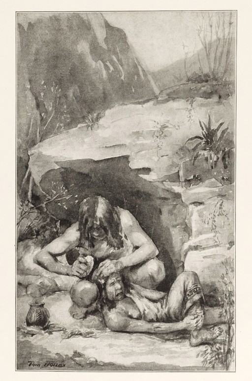 Illustration depicting prehistoric surgical operation.