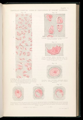 Protoplasm, or, Life, matter and mind / by Lionel S. Beale.