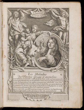 Des maladies des femmes grosses et accouchées. Avec la bonne et veritable méthode de les bien aider en leurs accouchemens naturels, & les moyens de remedier à tous ceux qui sont contre-nature, & aux indispositions des enfans nouveau-nés: ensemble une tres-exacte description de toutes les parties de la femme qui sont destinées à la generation ... / composé par François Mauriceau maistre chirurgien iuré à Paris.