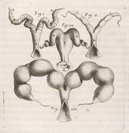 Des maladies des femmes grosses et accouchées. Avec la bonne et veritable méthode de les bien aider en leurs accouchemens naturels, & les moyens de remedier à tous ceux qui sont contre-nature, & aux indispositions des enfans nouveau-nés: ensemble une tres-exacte description de toutes les parties de la femme qui sont destinées à la generation ... / composé par François Mauriceau maistre chirurgien iuré à Paris.