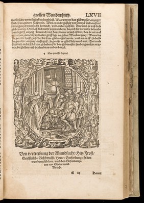 Opus chyrurgicum, des weitberumbten Hochgelehrten und Erfarnen / Aureoli Theophrasti Paracelsi ... Wund und Artzney Buch. Darinnen begriffen welchermassen allerhandt Kränck, Gebresten unnd Mängel, so dem menschlichen Geschlecht täglich zü gewarten, nicht allein innerlich, sonder auch eusserlich, als offne Wunden und Schäden, Gewechsz, Gebresten, Frantzosen, Blatern, Lähme und dergleichen gefährliche Kranckheiten, wie dieselbigen ... in diesem neuwen herrlichen Büch züfinden, ausz Grund der rechten und warhafftigen Kunst der Artzney mögen und sollen curiert und geheylt werden. Sampt vier Büchern wolermeldts Theophrasti Paracelsi so jetzt erst hinzü kommen. Alles ... durch Herrn Adam von Bodenstein ... in Truck geben.