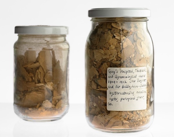 Powder produced from the decay of medical records. Jars.