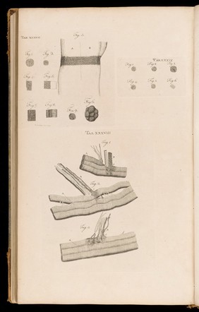 Observations on the structure and functions of the nervous system. Illustrated with tables / By Alexander Monro.