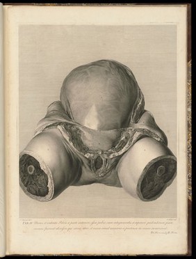 Anatomia uteri humani gravidi tabulis illustrata ... The anatomy of the human gravid uteris exhibited in figures / [William Hunter].