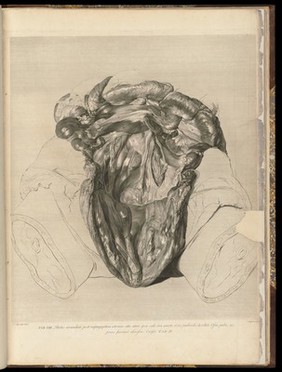 Anatomia uteri humani gravidi tabulis illustrata ... The anatomy of the human gravid uteris exhibited in figures / [William Hunter].