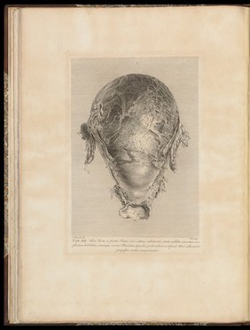 Anatomia uteri humani gravidi tabulis illustrata ... The anatomy of the human gravid uteris exhibited in figures / [William Hunter].