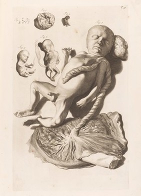 Illustration of male foetus with placenta