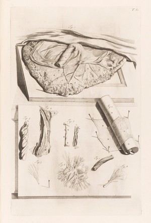 view Illustration of a placenta, with additional parts shown underneath