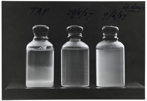 TAF (acid-fast bacilli) opacity photographs: 4 days to settle