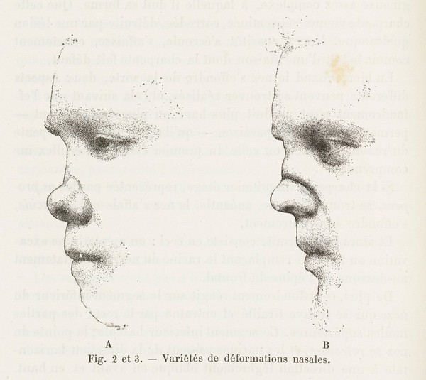 La syphilis héréditaire tardive : leçons professées / par Alfred Fournier.