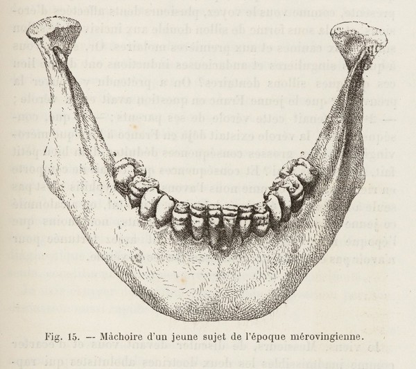 La syphilis héréditaire tardive : leçons professées / par Alfred Fournier.