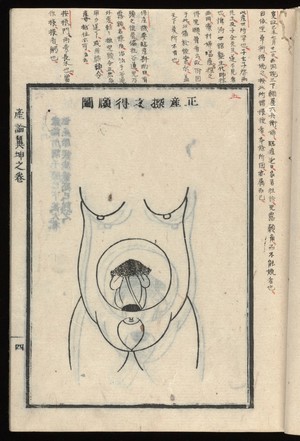 view San Ron Yoku. Book on obstetrics - volume 2