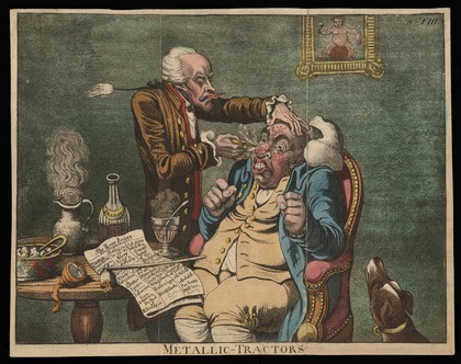 An operator treating the carbuncled nose of an obese patient with "Perkins's tractors". Coloured aquatint after J. Gillray, 1801.