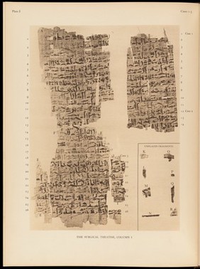 The Edwin Smith surgical papyrus : published in facsimile and hieroglyphic transliteration with translation and commentary in two volumes / by James Henry Breasted.