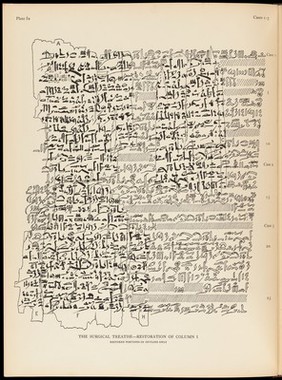 Page from Edwin Smith surgical papyrus..