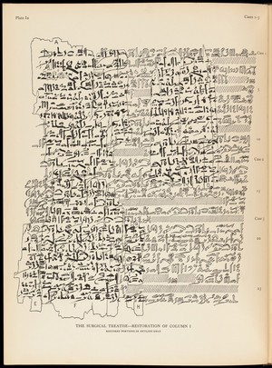 view Page from Edwin Smith surgical papyrus..