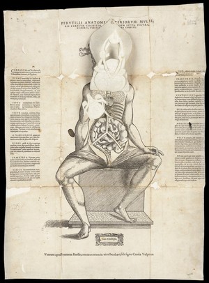 view Anatomical fugitive sheets