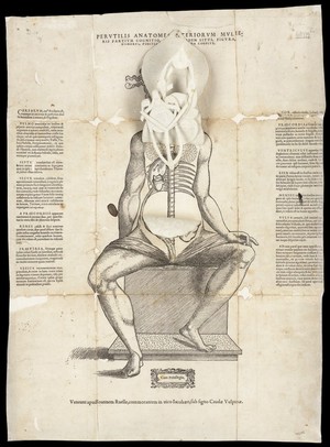 view Anatomical fugitive sheets