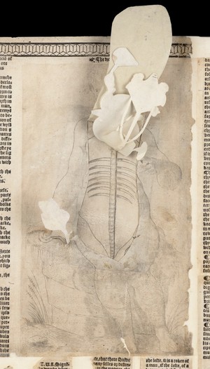 view Anatomical fugitive sheets