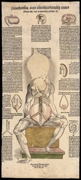 Anatomical fugitive sheets