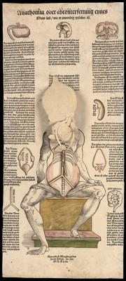 Anatomical fugitive sheets