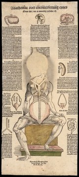 Anatomical fugitive sheets