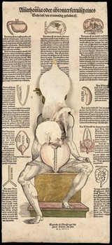 Anatomical fugitive sheets