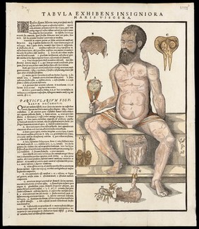[Anatomical fugitive sheets of a skeleton, male figure and a female figure.].