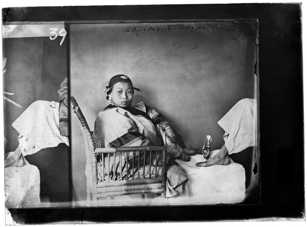 Woman with bound feet, photograph by John Thomson