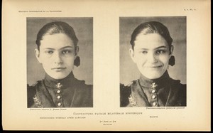 view Two photographs showing different facial expressions