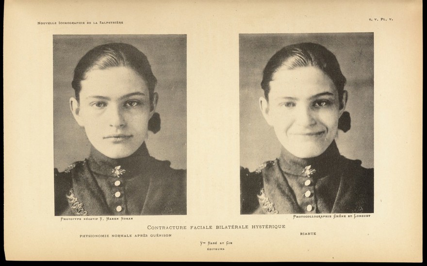 Two photographs showing different facial expressions