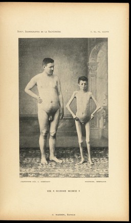 Photograph described as showing a 'Man Mummy'. Caption: 'Un "Homme Momie"'