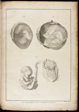 Icones embryonum humanorum.