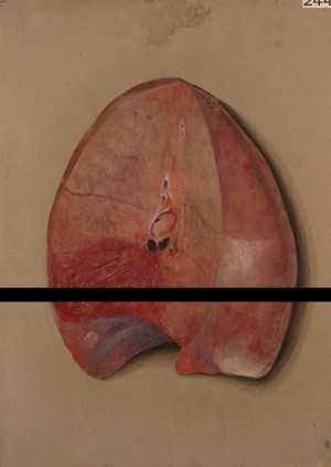 view Lung showing effects of pleuro-pneumonia