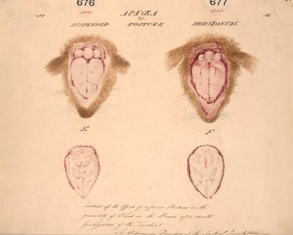 Effects of post mortem posture on the blood in the brains of two rabbits