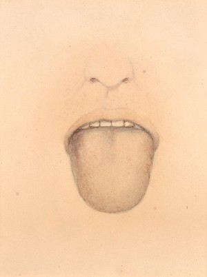 view Smooth tongue from an anaemic woman