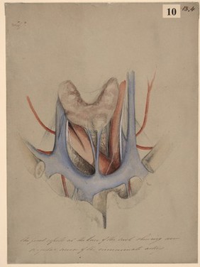 Great vessels at the base of the neck showing an irregular course of the innominate artery