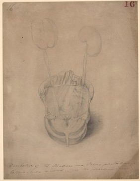 Dissection of the bladder and pelvis from a case of ectopia vesicae