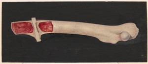 view Femur of a rabbit showing absorption of dead bone