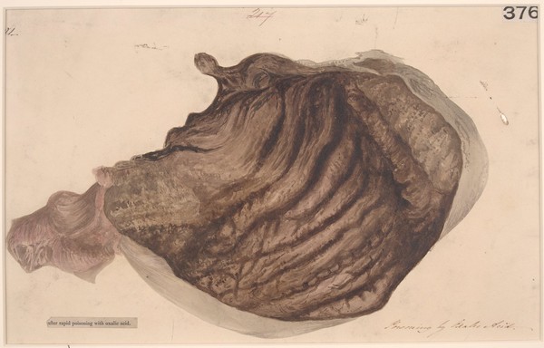 Interior of the stomach after poisoning with prussic acid