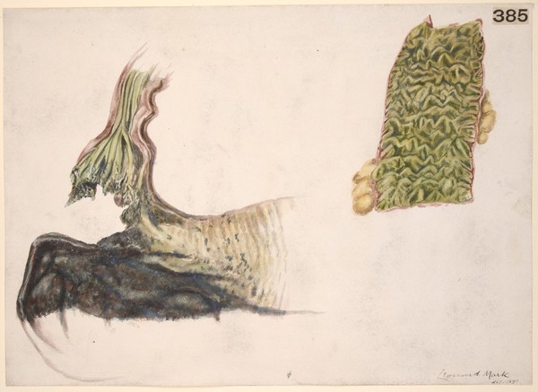 Stomach and intestine from a case of poisoning by perchloride of mercury