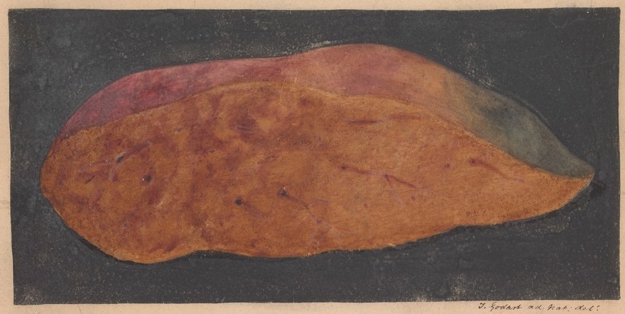 Liver from a case of acute yellow atrophy