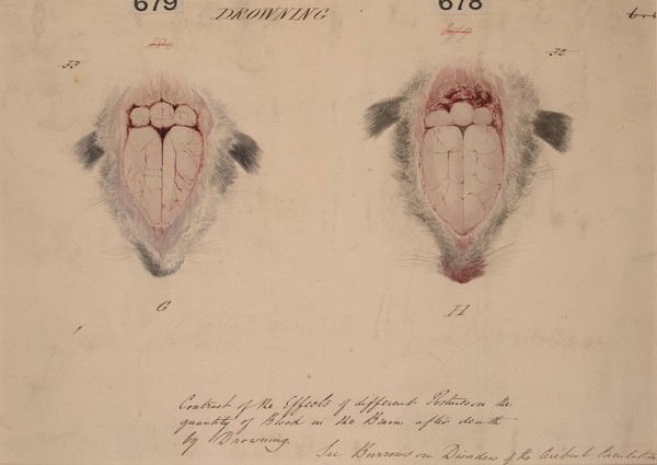 Effects on the blood in the brains of two rabbits after death by drowning