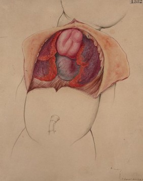 Thoracic organs of a newly-born child