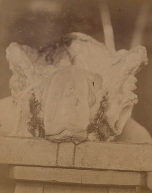 view Small, round female pelvis