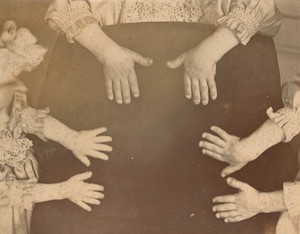 view Hands of three sisters with achondroplasia