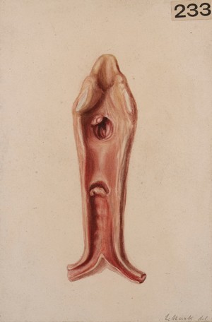 view Interior of a larynx after tracheotomy