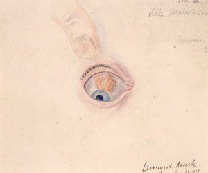 view Eye with yellowish opaque swelling in the ciliary region