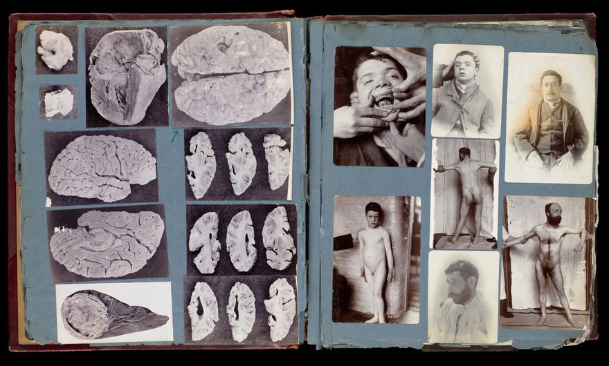 Friern Hospital, Friern Barnet: patients. Photographs, 1890-1910.