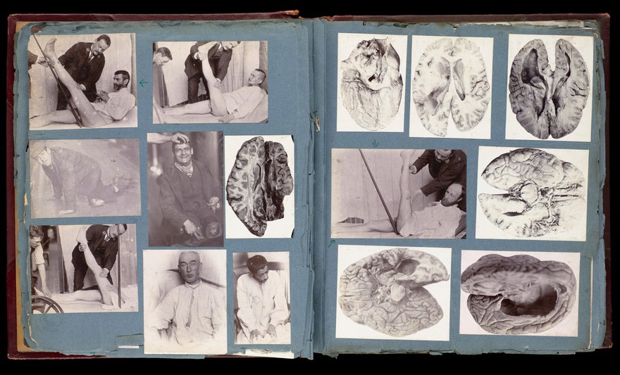 Friern Hospital, Friern Barnet: patients. Photographs, 1890-1910.